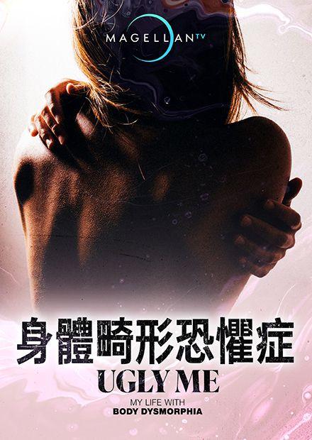 身體畸形恐懼症