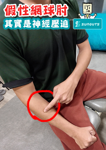 打球長期手臂痛，其實是