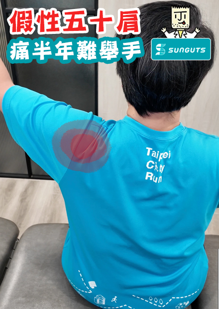 痛半年難舉手，其實是『假性五十肩』