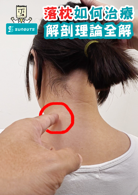 【第一視角】落枕如何治療？解剖理論全解，為何你總是越按摩越痛